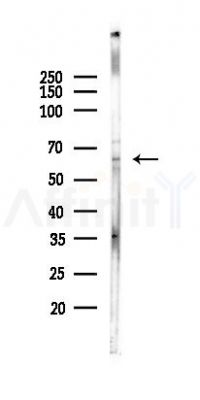 TMEM123 Antibody - Western blot analysis of lysates from PC12 cells(UV, 30min treatment), using TMEM123 Antibody at 1/1000 dilution.