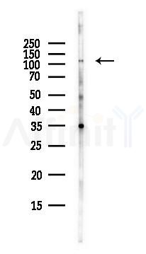 ABI3BP Antibody - Western blot analysis of lysates from EC304 cells(heat-shock,45min treatment), using ABI3BP Antibody at 1/1000 dilution.