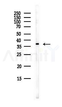 NAXD Antibody - Western blot analysis of lysates from EC304 cells(heat-shock,45min treatment), using NAXD Antibody at 1/1000 dilution.