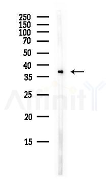NAXD Antibody - Western blot analysis of lysates from B16F10-LUC cells(starvation,24h treatment), using NAXD Antibody at 1/1000 dilution.