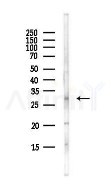 SLC25A34 Antibody - Western blot analysis of lysates from EC304 cells(heat-shock,45min treatment), using SLC25A34 Antibody at 1/1000 dilution.