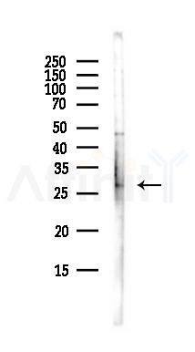 HACD4 Antibody - Western blot analysis of lysates from EC304 cells(heat-shock,45min treatment), using HACD4 Antibody at 1/1000 dilution.