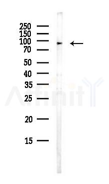 TSR1 Antibody - Western blot analysis of lysates from EC304 cells(heat-shock,45min treatment), using TSR1 Antibody at 1/1000 dilution.