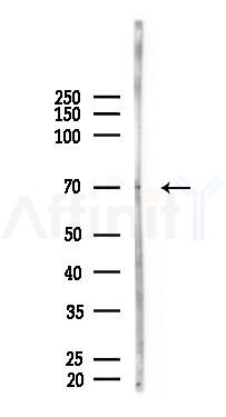 KIRREL2 Antibody - Western blot analysis of lysates from LoVo cells(heat-shock, 45min treatment), using KIRREL2 Antibody at 1/1000 dilution.
