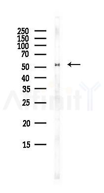 ZDHHC14 Antibody - Western blot analysis of lysates from EC304 cells(heat-shock,45min treatment), using ZDHHC14 Antibody at 1/1000 dilution.