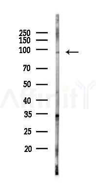 TMEM63B Antibody - Western blot analysis of lysates from PC12 cells(UV, 30min treatment), using TMEM63B Antibody at 1/1000 dilution.