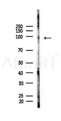TMEM63B Antibody - Western blot analysis of lysates from LoVo cells(heat-shock, 45min treatment), using TMEM63B Antibody at 1/1000 dilution.