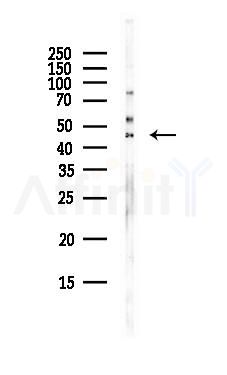 KIAA0930 Antibody - Western blot analysis of lysates from EC304 cells(heat-shock,45min treatment), using KIAA0930 Antibody at 1/1000 dilution.
