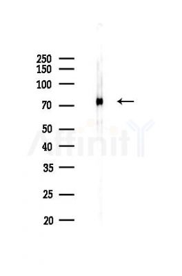 HAL Antibody - Western blot analysis of lysates from Rat liver, using HAL Antibody at 1/1000 dilution.