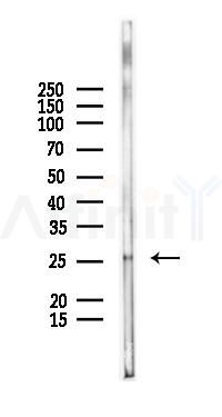 NIPSNAP3A Antibody - Western blot analysis of lysates from Mouse kidney, using NIPSNAP3A Antibody at 1/1000 dilution.