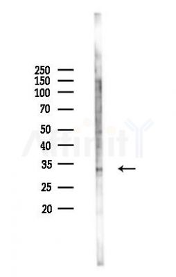 RNASEH2A Antibody - Western blot analysis of lysates from COLO205 cells(heat-shock,45min treatment), using RNASEH2A Antibody at 1/1000 dilution.