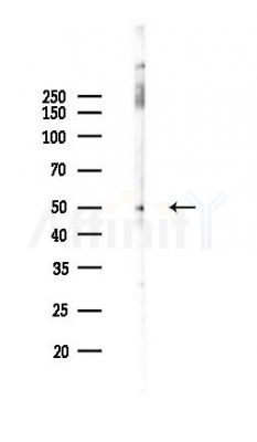 SLC36A2 Antibody - Western blot analysis of lysates from Rat liver, using SLC36A2 Antibody at 1/1000 dilution.
