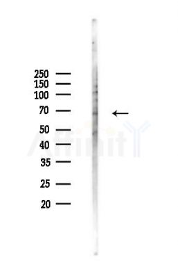 SLC22A14 Antibody - Western blot analysis of lysates from COLO205 cells(heat-shock,45min treatment), using SLC22A14 Antibody at 1/1000 dilution.