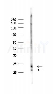 TM4SF4 Antibody - Western blot analysis of lysates from Rat liver, using TM4SF4 Antibody at 1/1000 dilution.