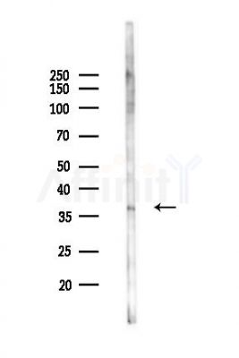 PRR11 Antibody - Western blot analysis of lysates from Rat liver, using PRR11 Antibody at 1/1000 dilution.