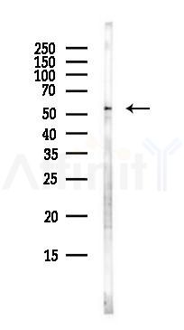 GRAMD2A Antibody - Western blot analysis of lysates from EC304 cells(heat-shock,45min treatment), using GRAMD2A Antibody at 1/1000 dilution.