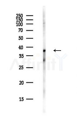 ZNF696 Antibody - Western blot analysis of lysates from PC12 cells(heat-shock,45min treatment), using ZNF696 Antibody at 1/1000 dilution.