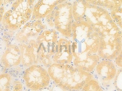 B3GALNT2 Antibody - DF15917 at 1/100 staining human normal kidney tissue by IHC-P.