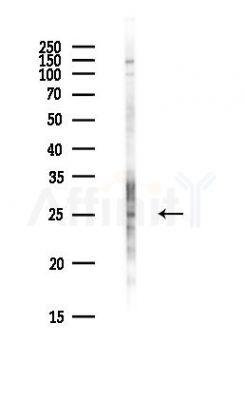 METTL21A Antibody - Western blot analysis of lysates from PC12 cells(heat-shock,45min treatment), using METTL21A Antibody at 1/1000 dilution.