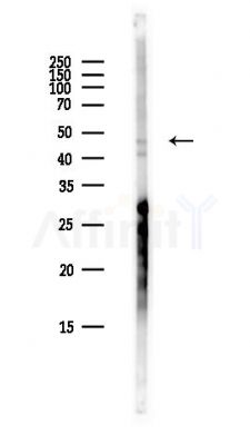 ADSSL1 Antibody - Western blot analysis of lysates from Hela cells(heat-shock,45min treatment), using ADSSL1 Antibody at 1/1000 dilution.