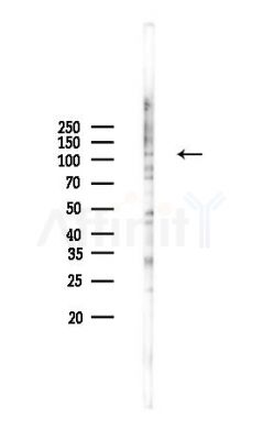 EML4 Antibody - Western blot analysis of lysates from MCF7 cells(heat-shock,45min treatment), using EML4 Antibody at 1/1000 dilution.