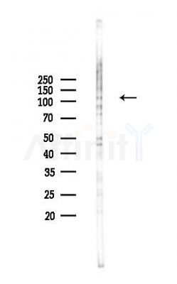 EML4 Antibody - Western blot analysis of lysates from COLO205 cells(heat-shock,45min treatment), using EML4 Antibody at 1/1000 dilution.