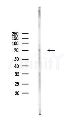 DMWD Antibody - Western blot analysis of lysates from COLO205 cells(heat-shock,45min treatment), using DMWD Antibody at 1/1000 dilution.