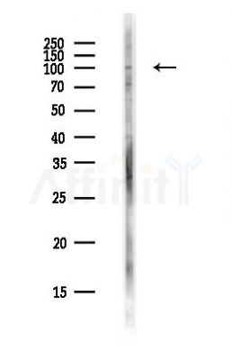 ZNF574 Antibody - Western blot analysis of lysates from PC12 cells(heat-shock,45min treatment), using ZNF574 Antibody at 1/1000 dilution.