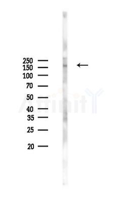 GAPVD1 Antibody - Western blot analysis of lysates from MCF7 cells(heat-shock,45min treatment), using GAPVD1 Antibody at 1/1000 dilution.