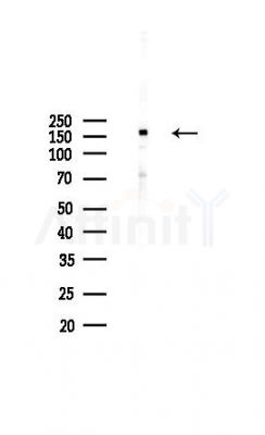 RAD54L2 Antibody - Western blot analysis of lysates from COLO205 cells(heat-shock,45min treatment), using RAD54L2 Antibody at 1/1000 dilution.