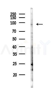 NOP2 Antibody - Western blot analysis of lysates from HepG2 cells(LPS,4h treatment), using NOP2 Antibody at 1/1000 dilution.