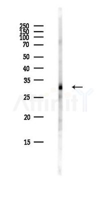 TEX264 Antibody - Western blot analysis of lysates from Hela cells(heat-shock,45min treatment), using TEX264 Antibody at 1/1000 dilution.