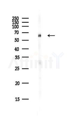 FBXO31 Antibody - Western blot analysis of lysates from PC12 cells(heat-shock,45min treatment), using FBXO31 Antibody at 1/1000 dilution.