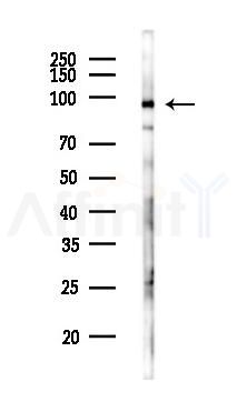 WDR70 Antibody - Western blot analysis of lysates from HepG2 cells(LPS,4h treatment), using WDR70 Antibody at 1/1000 dilution.