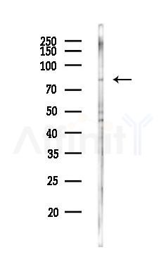 KLHL4 Antibody - Western blot analysis of lysates from HepG2 cells(LPS,4h treatment), using KLHL4 Antibody at 1/1000 dilution.
