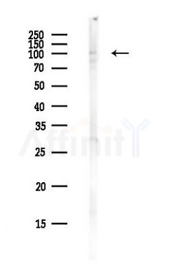 MATN2 Antibody - Western blot analysis of lysates from PC12 cells(heat-shock,45min treatment), using MATN2 Antibody at 1/1000 dilution.