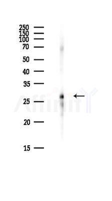 ZMYND19 Antibody - Western blot analysis of lysates from Hela cells(heat-shock,45min treatment), using ZMYND19 Antibody at 1/1000 dilution.