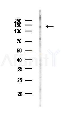 SEC31A Antibody - Western blot analysis of lysates from HepG2 cells(LPS,4h treatment), using SEC31A Antibody at 1/1000 dilution.