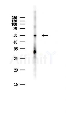 PRCC Antibody - Western blot analysis of lysates from Hela cells(heat-shock,45min treatment), using PRCC Antibody at 1/1000 dilution.