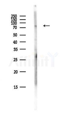 CCDC82 Antibody - Western blot analysis of lysates from Hela cells(heat-shock,45min treatment), using CCDC82 Antibody at 1/1000 dilution.