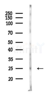 GSC Antibody - Western blot analysis of lysates from Rat liver, using GSC Antibody at 1/1000 dilution.