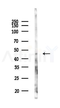 IGSF11 Antibody - Western blot analysis of lysates from HepG2 cells(LPS,4h treatment), using IGSF11 Antibody at 1/1000 dilution.