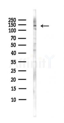 RFX1 Antibody - Western blot analysis of lysates from Hela cells(heat-shock,45min treatment), using RFX1 Antibody at 1/1000 dilution.