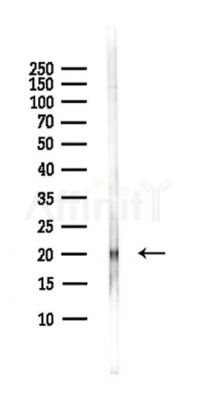 JOSD2 Antibody - Western blot analysis of lysates from Hela cells(heat-shock,45min treatment), using JOSD2 Antibody at 1/1000 dilution.