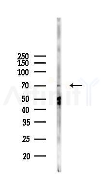 MPP7 Antibody - Western blot analysis of lysates from MCF7 cells(heat-shock,45min treatment), using MPP7 Antibody at 1/1000 dilution.