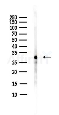 THAP10 Antibody - Western blot analysis of lysates from Hela cells(heat-shock,45min treatment), using THAP10 Antibody at 1/1000 dilution.