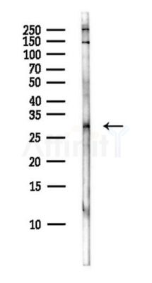 THAP10 Antibody - Western blot analysis of lysates from B16F10-LUC cells(starvation,24h treatment), using THAP10 Antibody at 1/1000 dilution.