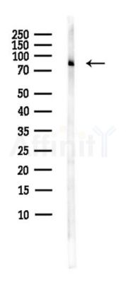 APEH Antibody - Western blot analysis of lysates from B16F10-LUC cells(starvation,24h treatment), using APEH Antibody at 1/1000 dilution.