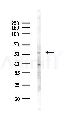 TRMT61B Antibody - Western blot analysis of lysates from HepG2 cells(LPS,4h treatment), using TRMT61B Antibody at 1/1000 dilution.
