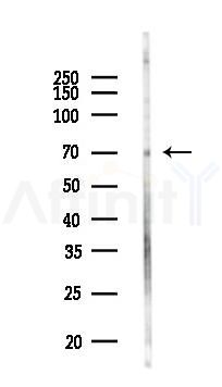 FBXO33 Antibody - Western blot analysis of lysates from HepG2 cells(LPS,4h treatment), using FBXO33 Antibody at 1/1000 dilution.